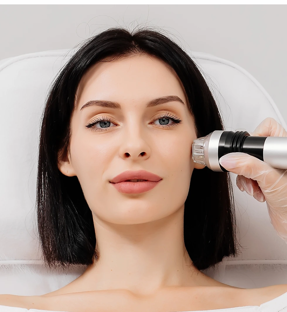 Woman receiving microdermabrasion treatment on her cheek with a handheld device